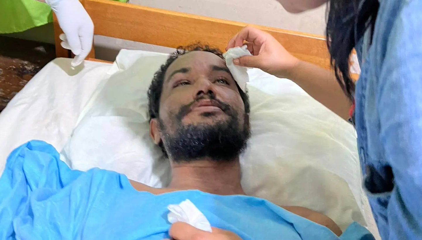 Man Survives 31 Days in Amazon Jungle After Being Separated From Friends Du …